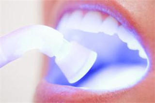 牙齒做冷光美白對身體有壞處嗎