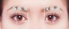 重慶華美開眼角手術需要多少錢