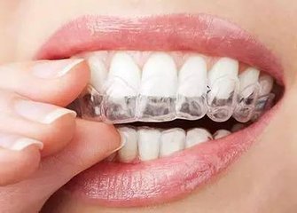 昆明口腔牙齒矯正效果好嗎