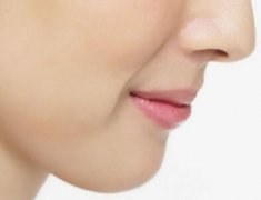 自體脂肪填充鼻唇溝的好處