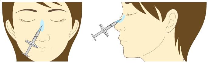 韓式假體隆鼻手術