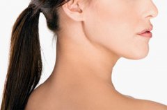 深圳頸部拉皮除皺后多久能恢復？