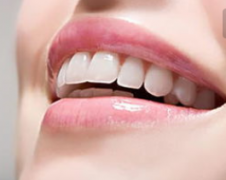 牙齒矯正能用多久？