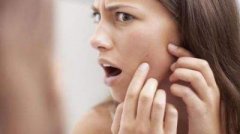激光祛痘印真的不會損傷皮膚嗎？