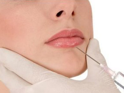 天津玻尿酸注射豐唇價格是多少錢？