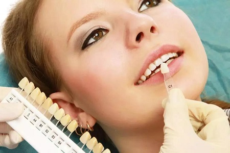牙齒矯正 VS 牙貼面 | 關閉牙縫應該pick哪一個？