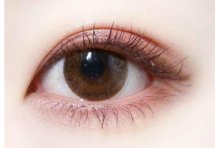 杭州雙眼皮修復術要注意什么？