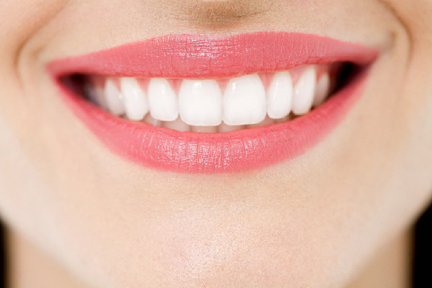 冷光牙齒美白的時間能夠維持多久？