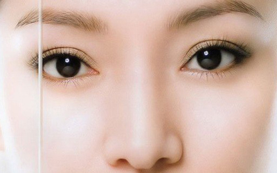 如何避免切開雙眼皮手術后留下疤痕?