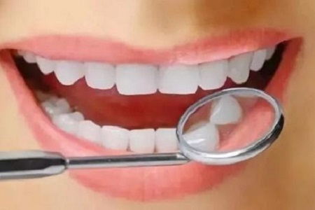 牙齒矯正費用多少