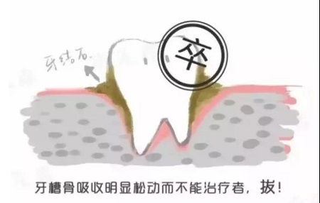 牙齒矯正可以用一輩子嗎？
