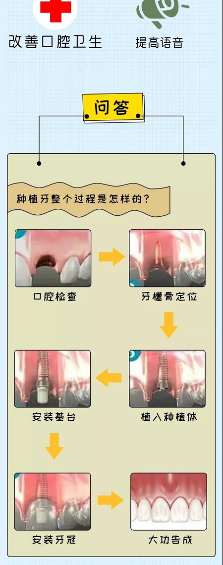 牙齒矯正可以用一輩子嗎？