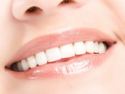 牙齒矯正一般是多少錢？