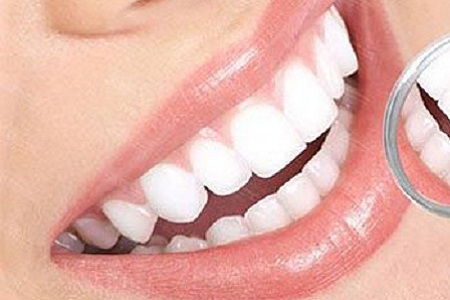 醫美白皮書：你以為別人潔白整齊的牙齒都是天生嗎？