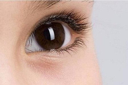 成都雙眼皮修復有哪些方法