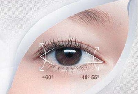 廣州雙眼皮手術價格多少