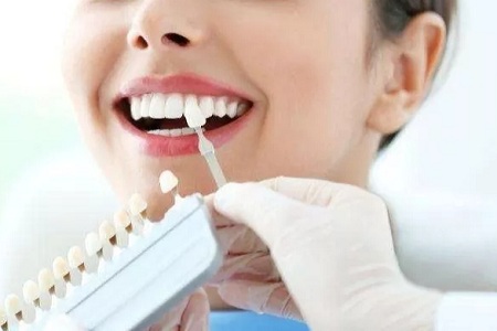 牙齒美白有哪些比較好的方法
