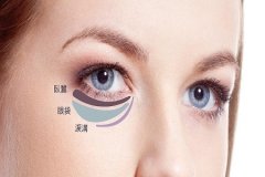 武漢祛眼袋術后如何護理