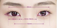 西安美萊雙眼皮手術選韓式三點還是全切