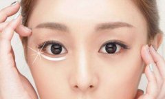 深圳美萊祛除眼袋的更好辦法是什么？