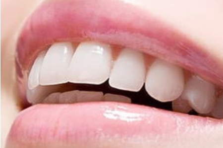 牙齒黃，做佛山牙齒美白維持多久