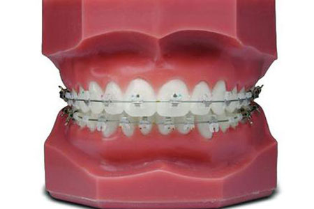 美萊隆重推出雙旦福利，報名體驗牙齒矯正黑科技iTero 口掃
