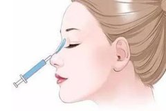 玻尿酸隆鼻子大概多少錢，隆鼻效果可以維持多久